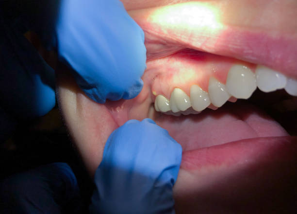 Best Pediatric Emergency Dentist in Turner, OR